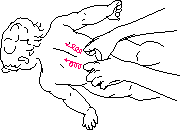 рис.5a(растирание поясничной области)