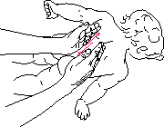 рис.5b(растирание поясничной области)