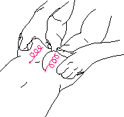 рис.6a(растирание ягодиц)